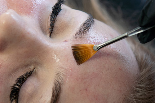 peeling-medyczny-kielce