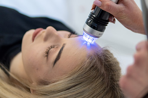 radiofrekwencja-mikroiglowa-kielce